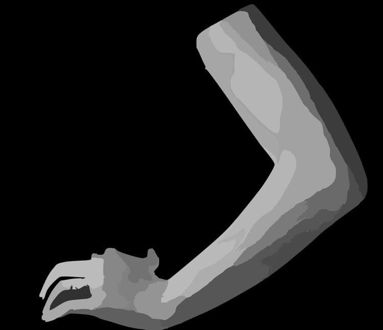 테니스 엘보 증상 원인 치료 방법 총정리(2024년) 2 테니스-엘보-원인